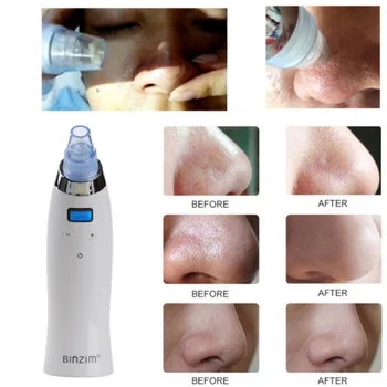 

Blackhead Remover Face Deep Nose Cleaner T Zone Pore Acne Pimple Removal Vacuum Suction Facial Diamond Beauty Clean Skin Tool