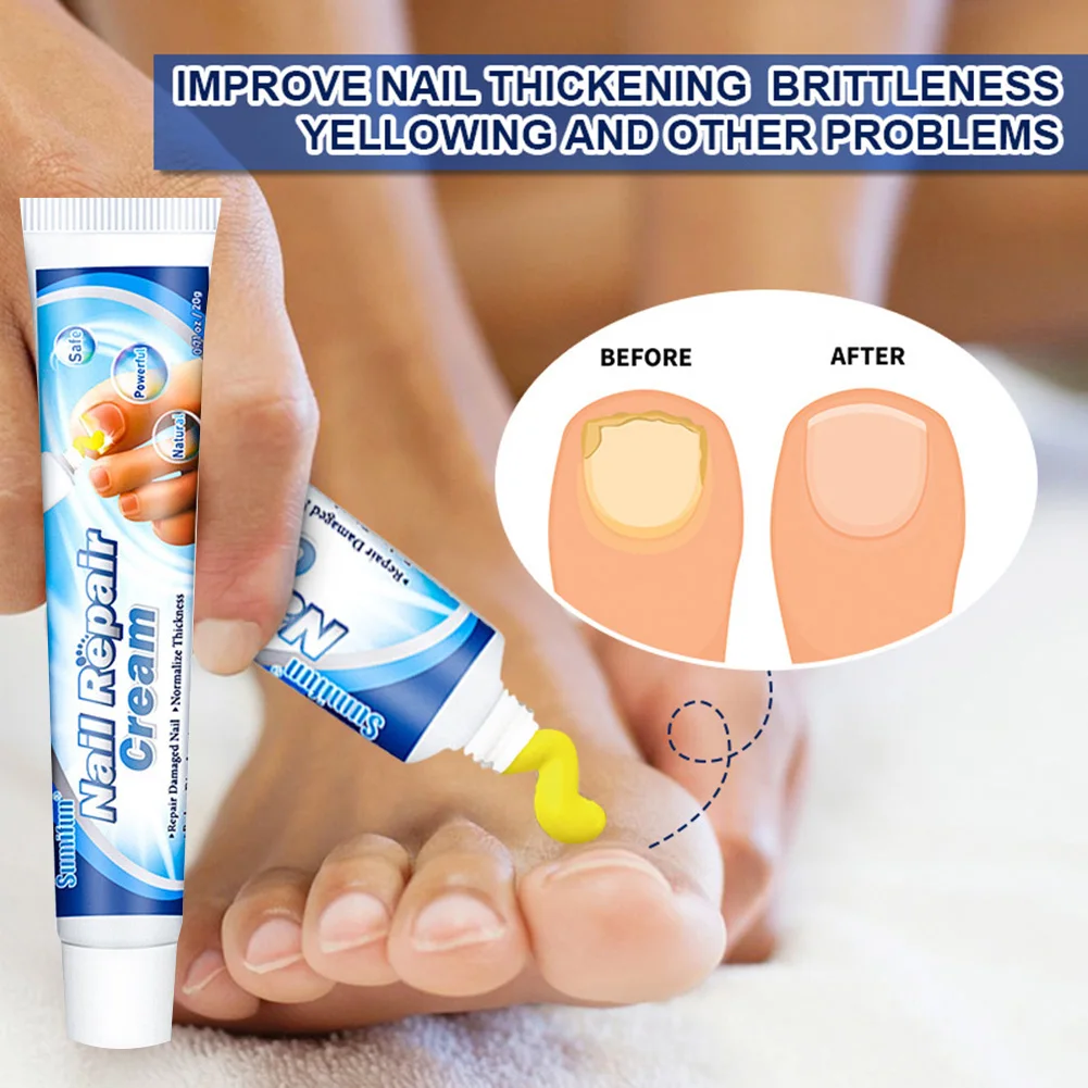 Мазь От Грибков Купить