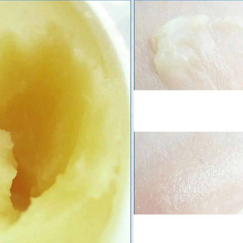 Anti Aging Wrinkle Moist Nourishing Facial Cream Lighten Acne Repair Skin Care 4