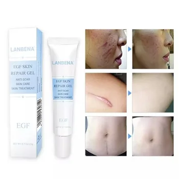 

LANBENA Tcm Scar Gel And Acne Mark Blackhead Removal Skin Repair Face Cream
