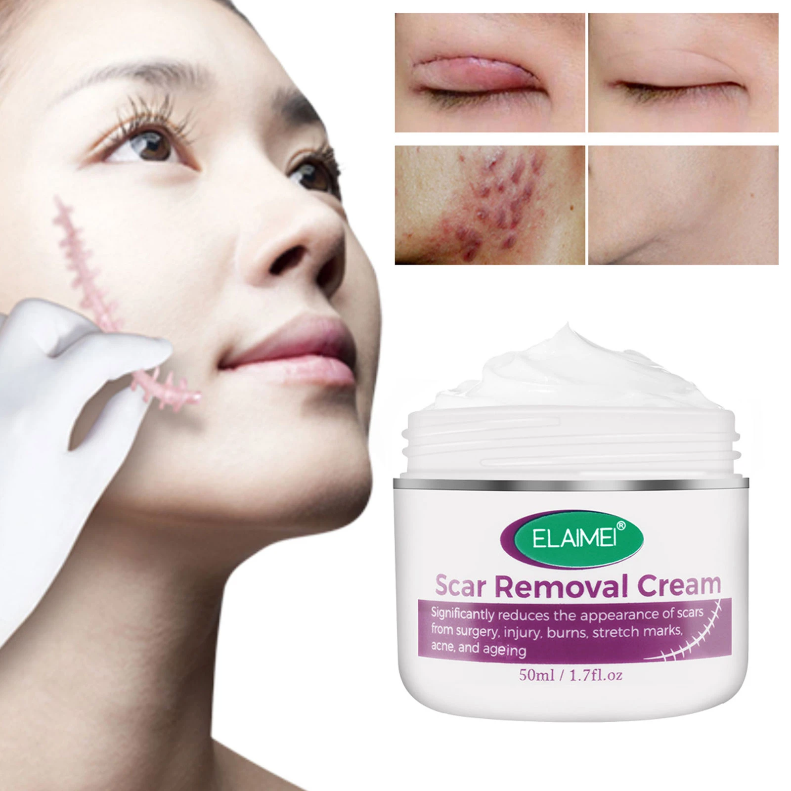 Elaimei Acne Scar Removal Cream Skin Repair Face Cream Acne Treatment
