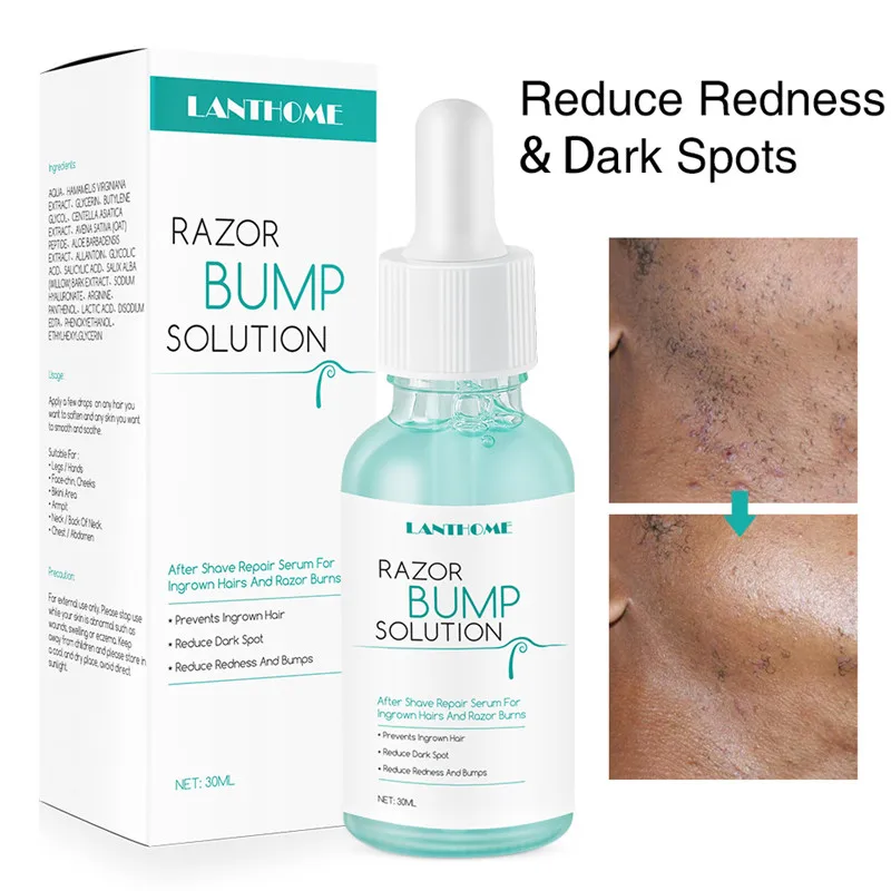 Ingrown Hairs Treatment After Shave Repair Reduce Redness&dark Spots