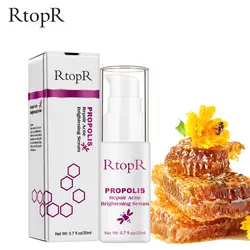 RtopR прополис лечение угрей осветляющая сыворотка контролирует масло для очистки пор и отбеливания кожи