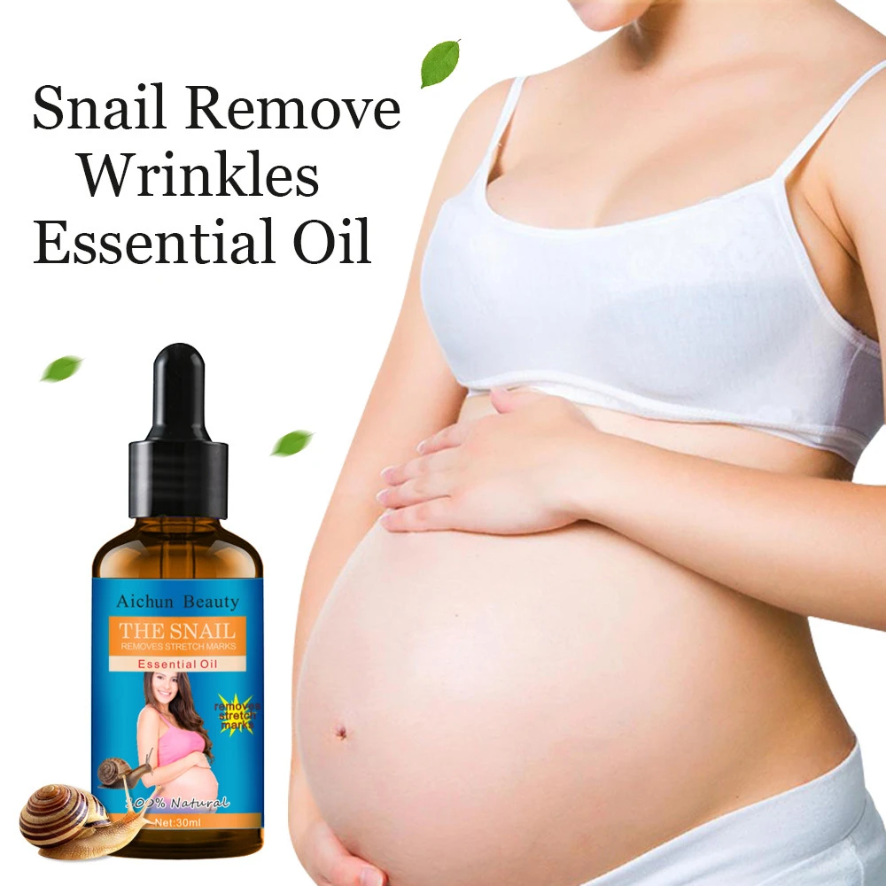 snail remove stretch marks cream