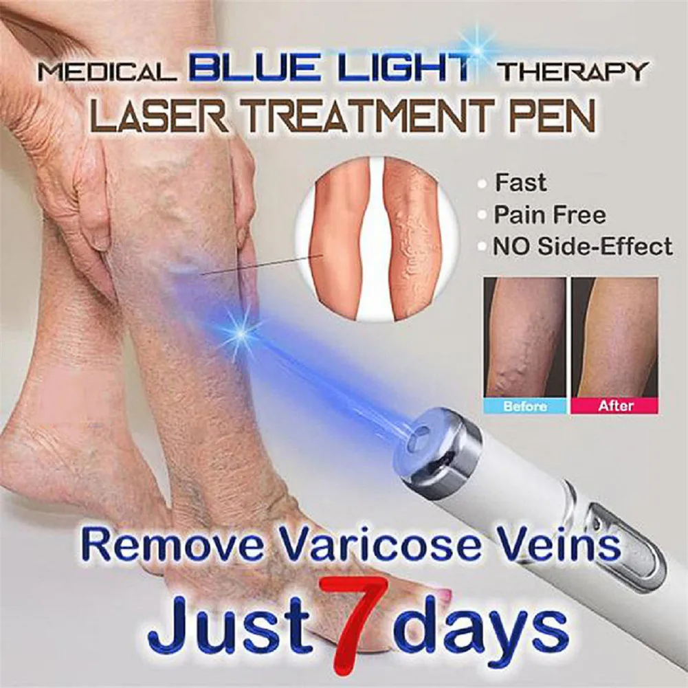 Синий светильник, лазерная ручка для лечения акне, массажер для лица, лечение мягких шрамов и морщин, устройство для удаления акне, уход за кожей, микроэффект