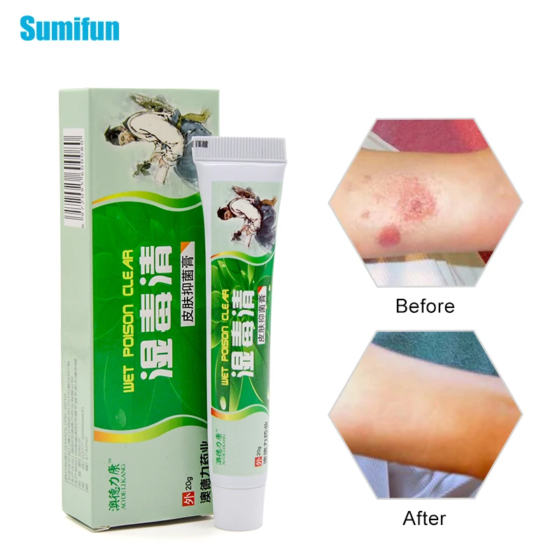 1pcs Dermatitis Eczema Antibacterial Cream Skin Psoriasis Treatment Ointment Skin Pruritus Care Relieve Cream P1058