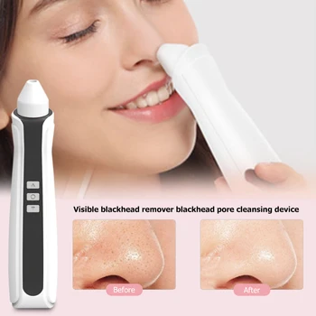 

USB Rechargeable Visual Blackhead Remover Facial Pore Acne Black Head Vacuum Suction Cleaner Camera Deep Nose High-quality