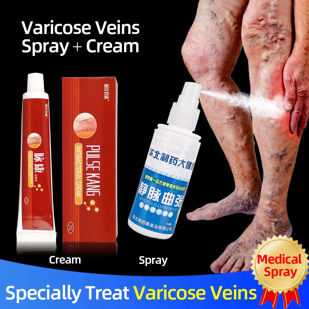 spray de la vene varicoase varicoase cauzele femeilor varicoase