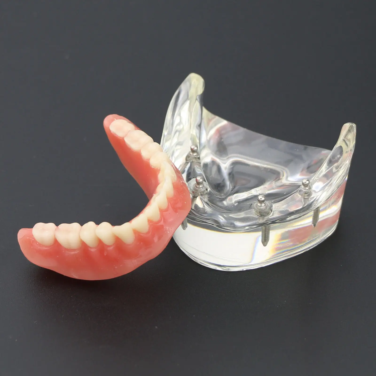 

1Pc Dental Teeth Study Model Overdenture Inferior 4 Implant Demo Model 6002 02