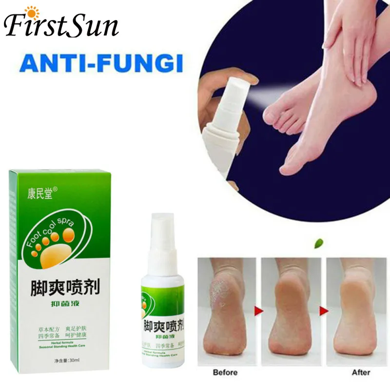 Herbal Anti-fungal Athlete Foot Spray Antibacterial Deodorant Powder Anti Itch Sweat Odor Liquid Anti-fungi Feet Care |