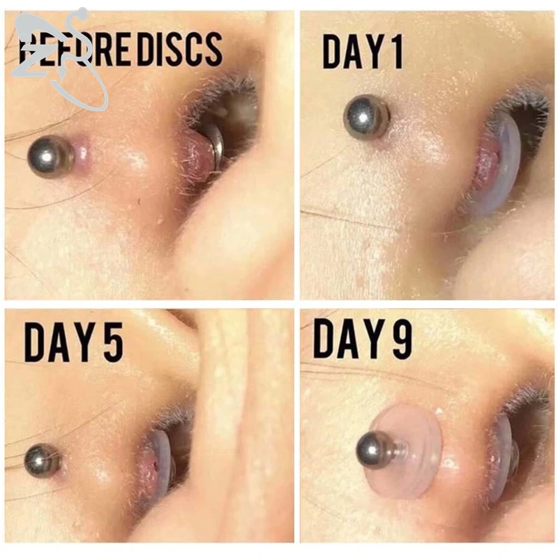 Silicone Piercing Healing Discs Flexible Anti Hyperplasia For The Back Of The Earrings Soft Anti Invagination ZS 6-200PCS/Lot piercing jewelry,body piercing jewelry,body jewelry