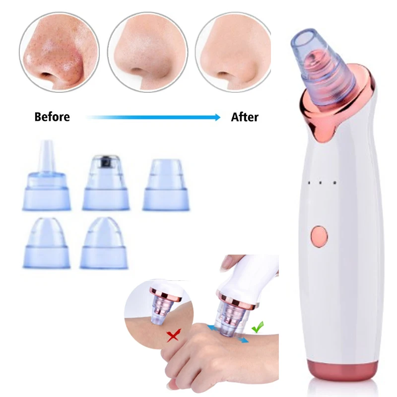 

Pore Cleaner Blackhead Remover Vacuum Electric Nose Face Deep Cleansing Skin Care Machine Birthday Gift Dropshipping Beauty Tool