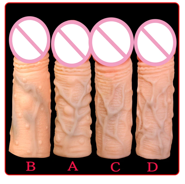 4 (17)