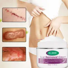 

50ml Scar Cream Easy to Absorb Fade Scars Skin Care Scar Skin Stretch Mark Treatment for Body Part