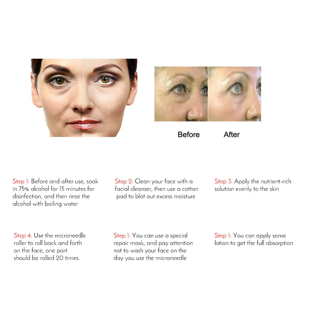 dermaroller cleanser