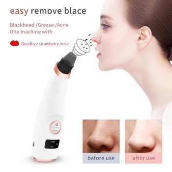 

Vacuum Cleaner Black Dots Electronic Blackhead Remover Machine Cleansing Instrument Skin Care Face Beauty