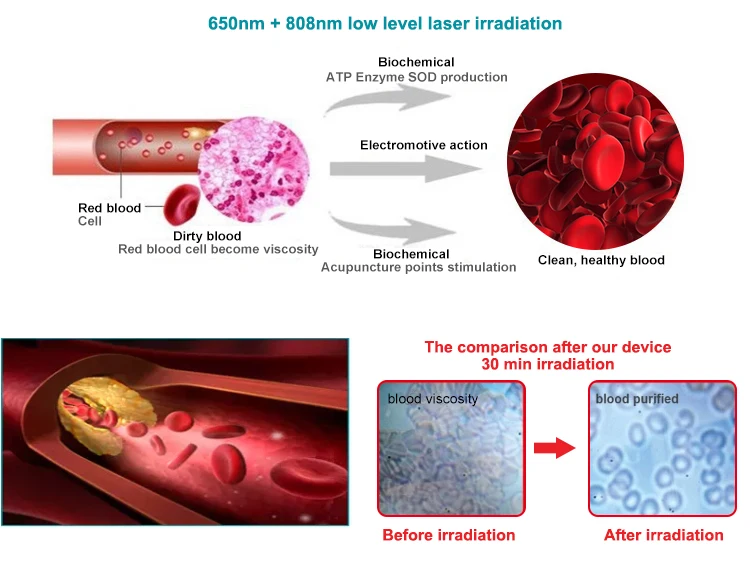 3 в 1 красный светильник для холодной лазерной терапии часы Semaiconductor LLLT наручные часы для дома пожилых диабет ринит боль в мышцах