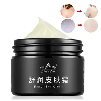 

Chinese Medicine Body Cream Remove Chicken Skin Whitening Moisturizing Skin Care Body Care 50 g
