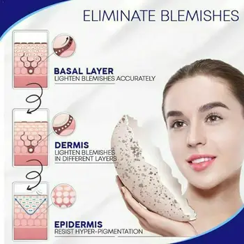 

20ML Freckles Acne Pimple Scar Dark Spots Removal Face Spots Quick Cream Removal Face Whitening Use Skin Cream M5M7