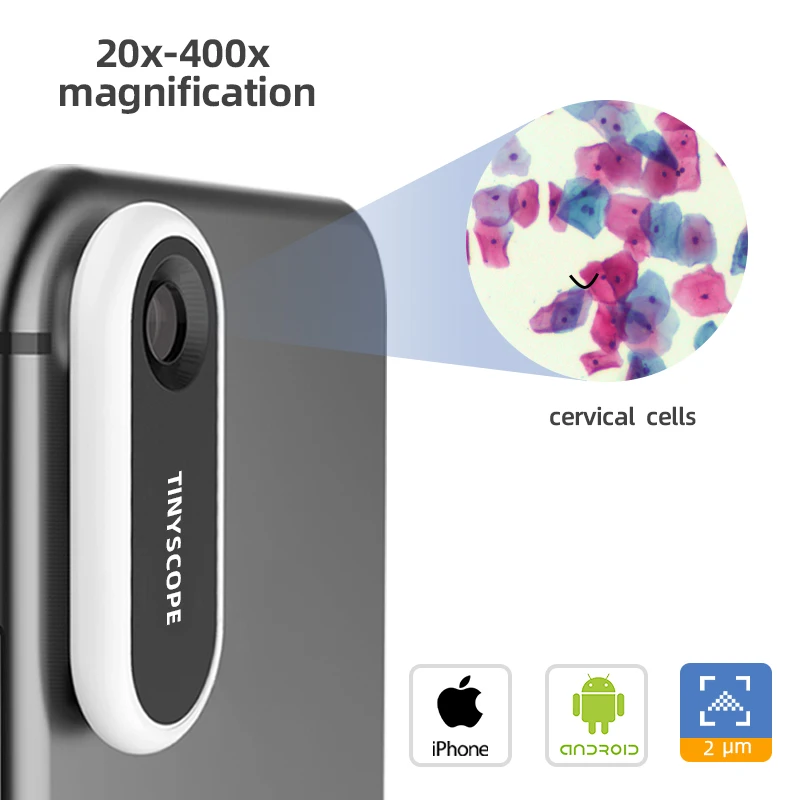 Tinyscope-lente de microscopio móvil de bolsillo, aumento 20x-400x, juguete educativo, microscopio portátil para todos los teléfonos inteligentes