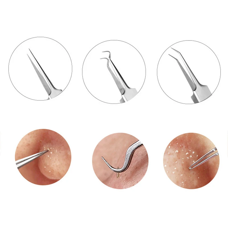 Blackhead Remover Acne Pimple Patch Extractor Acne Black Head Blemish Remover Ance Needles Pore Cleaner Face Skin Care Tools