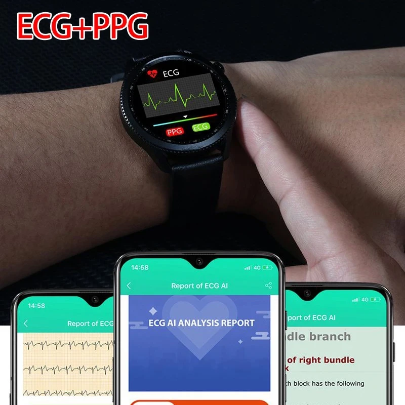 Samsung Galaxy Watch Orologio Da Polso Con Elettrocardiogramma