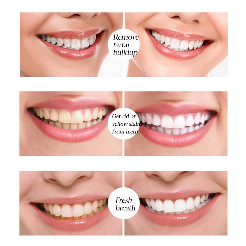 Teeth Whitening Pen Tooth Gel Whitener Bleaching Remove Plaque Stains Dental Tools Oral Hygiene Care Teeth Cleaning Serum