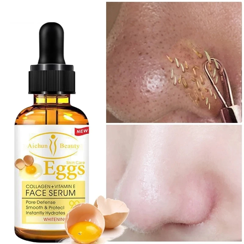 Correttore spot Sbiancamento scuro Siero sbiancante per il viso Illuminare le imperfezioni Rimozione delle lentiggini Essenza naturale di carota Corea_voghion.com