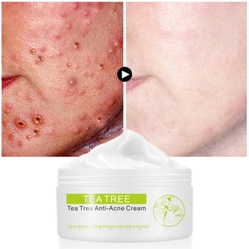 

High Quality Whitening Moisturizing Tea Tree Facial Cream Acne Scar Treatment Pore Shrink Oil Control Facial Skin Care