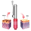 Needle-Free Hyaluronic Acid Pen Facial Skin Wrinkles Anti-aging Lip Lift Syringe 0.3ml Water Light Needle  Beauty Equipment Skin