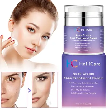 

Acne Treatment Cream Anti Acne Face Cream Pimple Blackhead Removal Spots Oil Control Shrink Pores Moisturizing Skin Care Serum