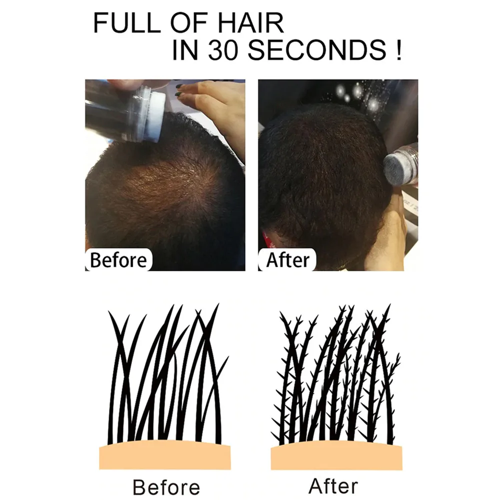 12g Treatment Thickening Spray Hair Building Fiber Unisex Washable One-Time Wig Salon Hairline Optimizer Dense Regrowth Powder 12g Treatment Thickening Spray Hair Building Fiber Unisex Washable One-Time Wig Salon Hairline Optimizer Dense Regrowth Powder