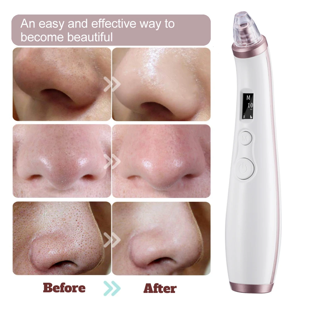 Электрический вакуумный ингалятор для удаления черных точек на носу акне |