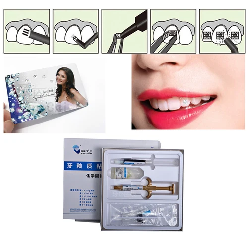 Diy Tooth Gem Kit Multifunctional With Curing Light Glue Professional  Ornament