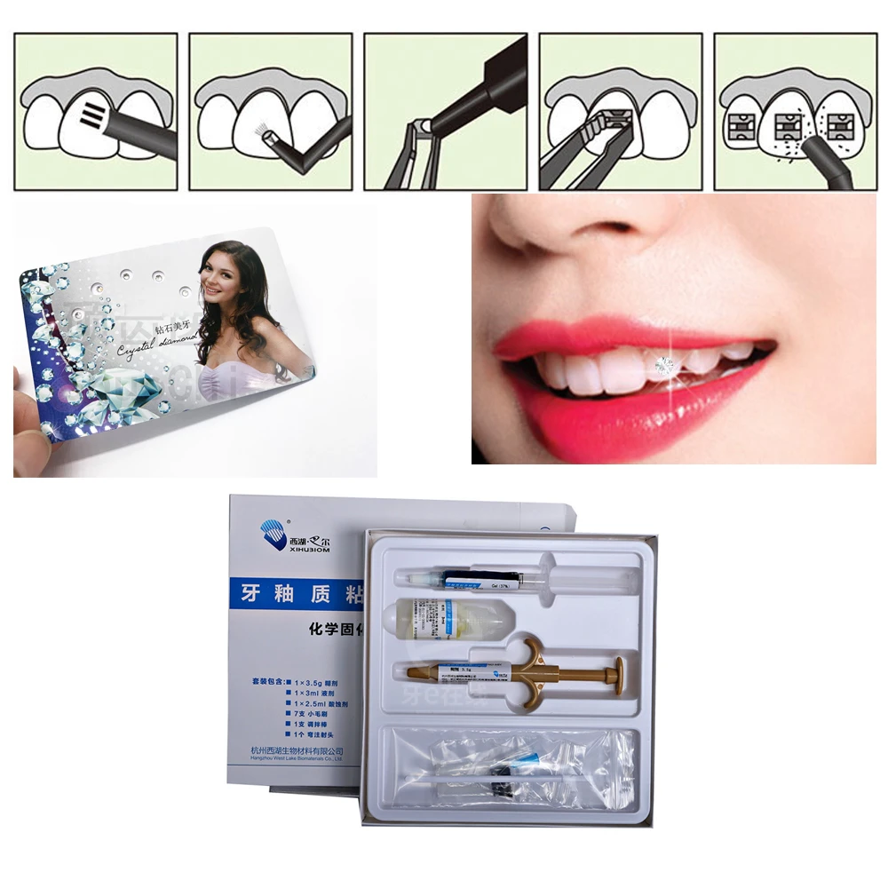 Dental Adhesive For Tooth Gems Diamond Kit Glue Teeth Crystal Jewelry