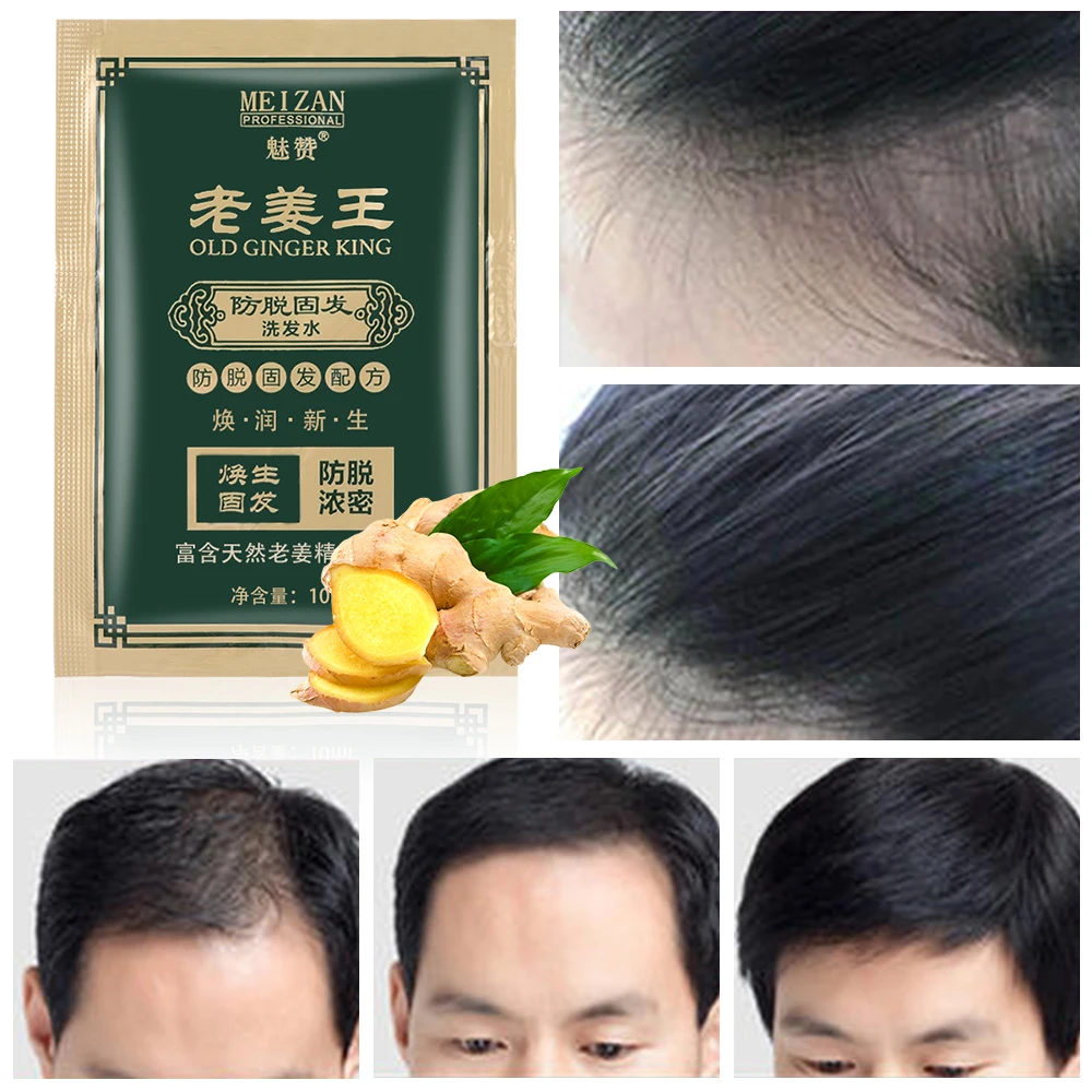 Имбирь шампунь для волос рост густой Восстанавливающий Сыворотка против выпадения волос масло натуральный экстракт лечение эссенция смягчение унисекс эффективный