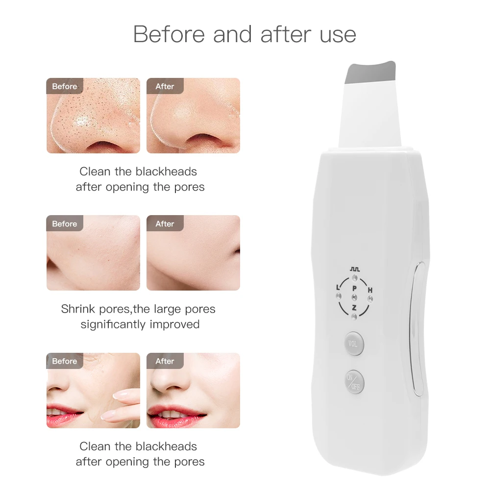 Ultrasonic Skin Scrubber Electric Facial Skin Cleaning Anion Face Acne Removal Ultrasound Peeling Skin Firming Cleaner Spatula