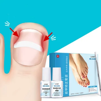 

Ingrown Corrective Suit Ingrown Nail Patch Nail File Nail Clipper Nail Cleanser Adhesive Paronychia Treatment Kit