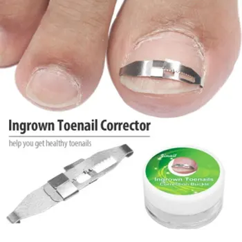 

Ingrown Toenail Corrector Toenail Correction Treatment Foot Care Tools Orthotic Nail Fixer Corrector Pedicure Recover Embed Tool