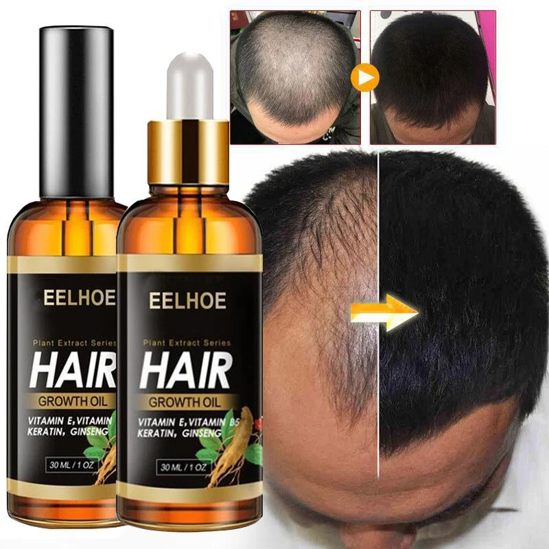 Hair Growth Essential Oil Products Anti Hair Loss Spray Serum Ginger
