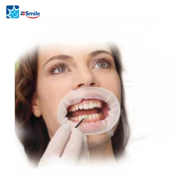 

Three-Dimensional Opening Device Dental Extraoral Cheek Retractor