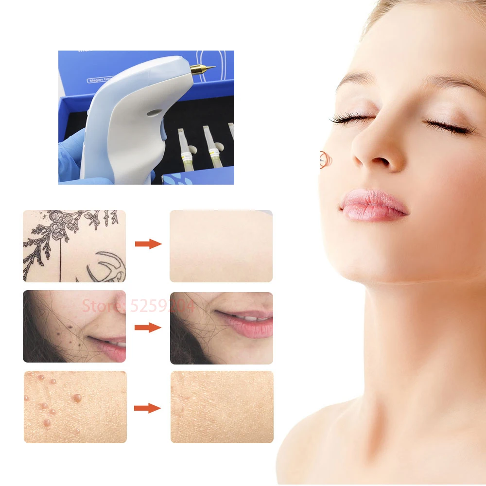 Máquina do Fibroblast da Pena do Plasma do Maglev da Remoção da Tatuagem da Sarda da Verruga do Ponto do Mole do Levantamento da Pele da Pálpebra da Pena do Plasma do Laser com Agulha Tatuagem Sarda Verruga Ponto Laser com Agulha da do 9 Utensílios de cuidado facial