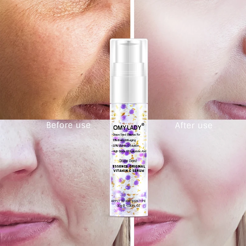 OMY LADY Grape Seed Face Serum Vitamin C Whitening and moisturizing Essence Deep hydration Firm skin anti-aging cream care OMY LADY Grape Seed Face Serum Vitamin C Whitening and moisturizing Essence Deep hydration Firm skin anti-aging cream care