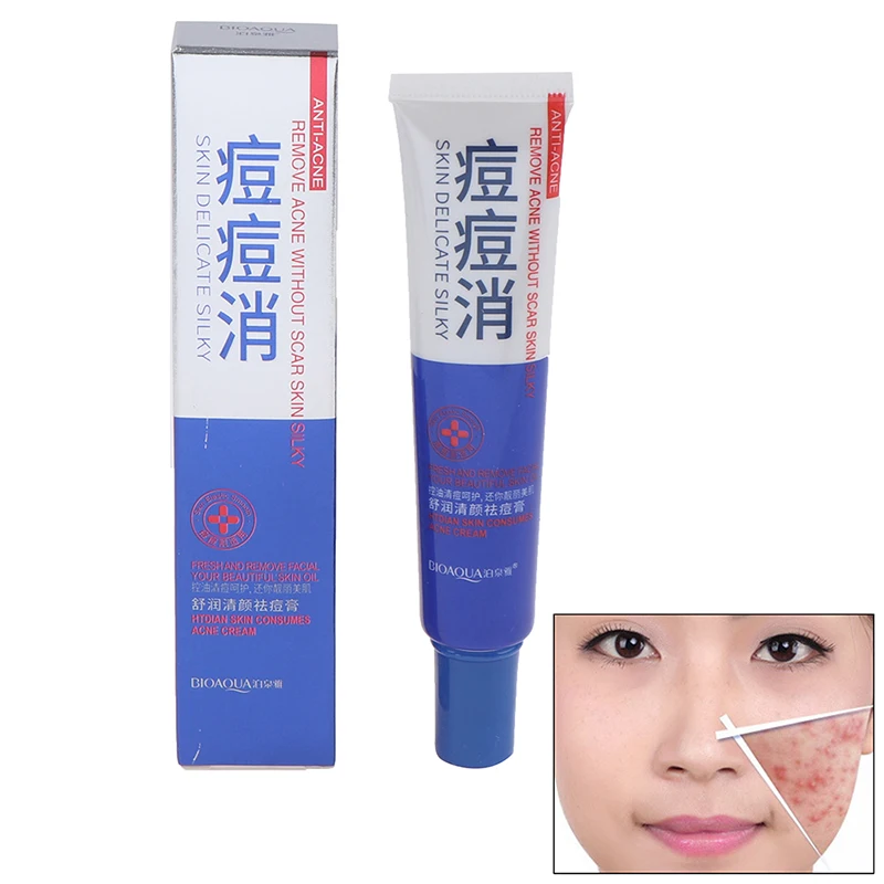 1pcs Anti Acne Cream Oil Control Shrink Pores Nourish Skin Acne Scar Remove Face Cream 30g
