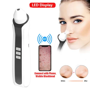 

Visual Blackhead Vacuum with Built-in Microscope HD Camera Review Pore Vacuum Cleaner WiFi Blackheads Remover Cleaner