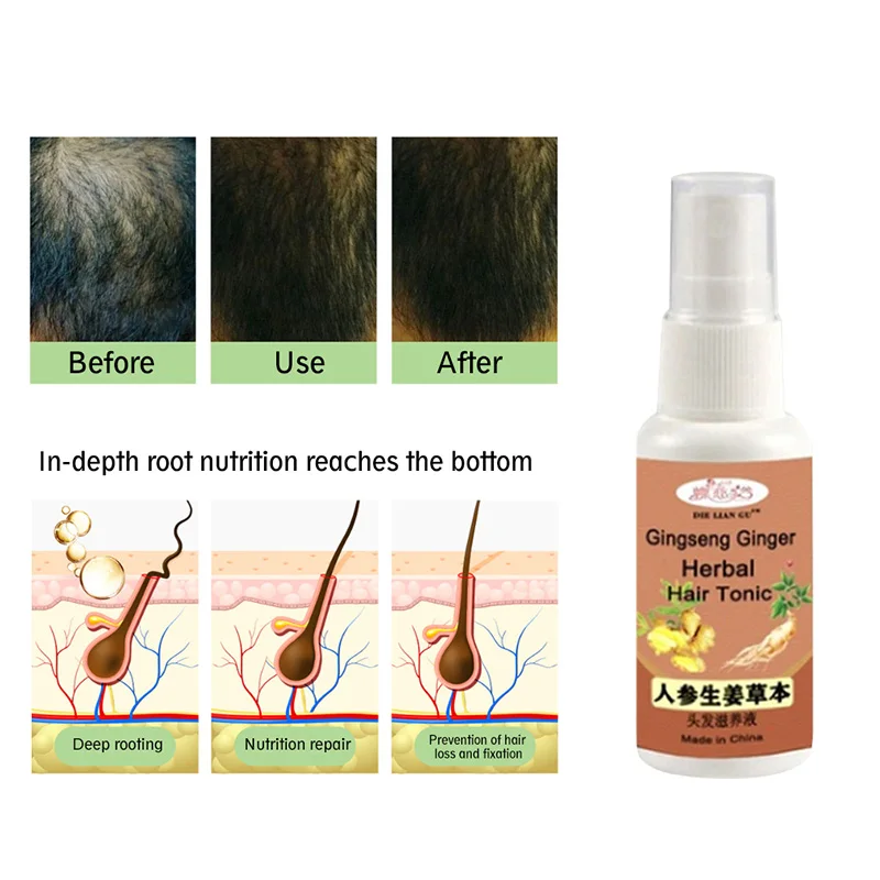 Ginseng Ginger Herbal Hair Tonic Nourishing Solution Repairs Hair Follicles Promotes Regrowth Hair & Scalp Treatments ZG88 Ginseng Ginger Herbal Hair Tonic Nourishing Solution Repairs Hair Follicles Promotes Regrowth Hair & Scalp Treatments ZG88