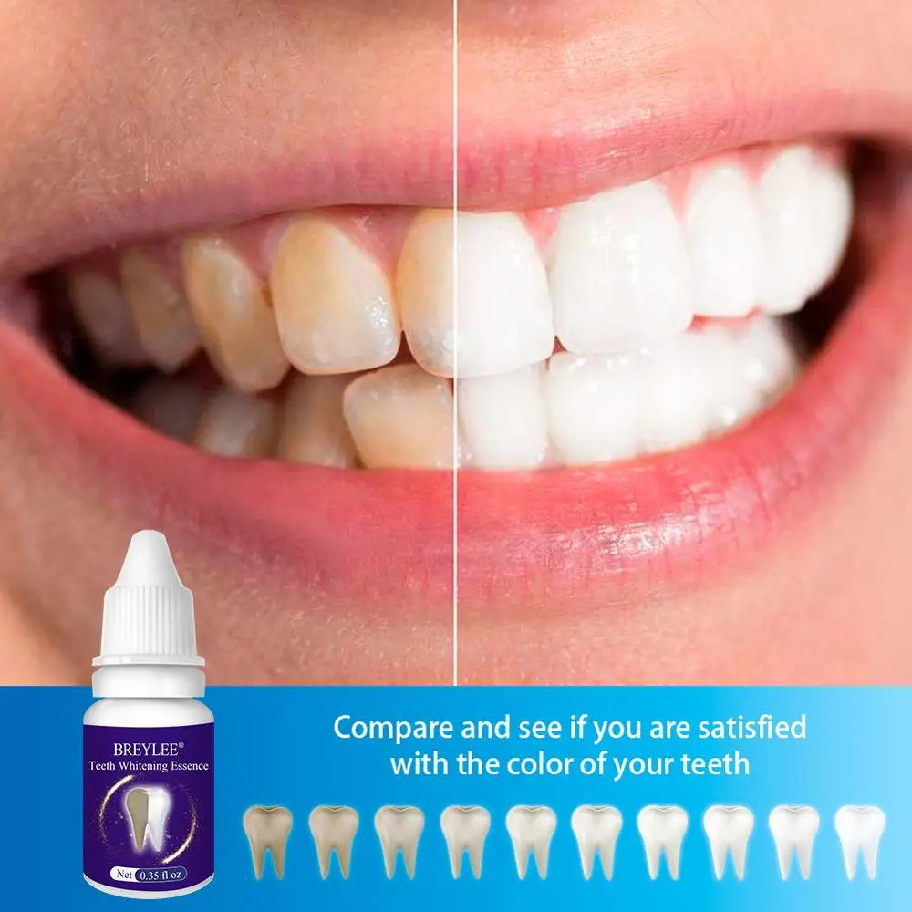 

Teeth Whitening Essence Remove Plaque Stains Dental Tools Tooth Whiten Cleaning Oral HygieneTooth Cleaning Serum Essence