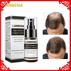 LANBENA средство для роста волос распылительный продукт Предотвращение облысения укрепление от выпадения волос питают корни легко носить