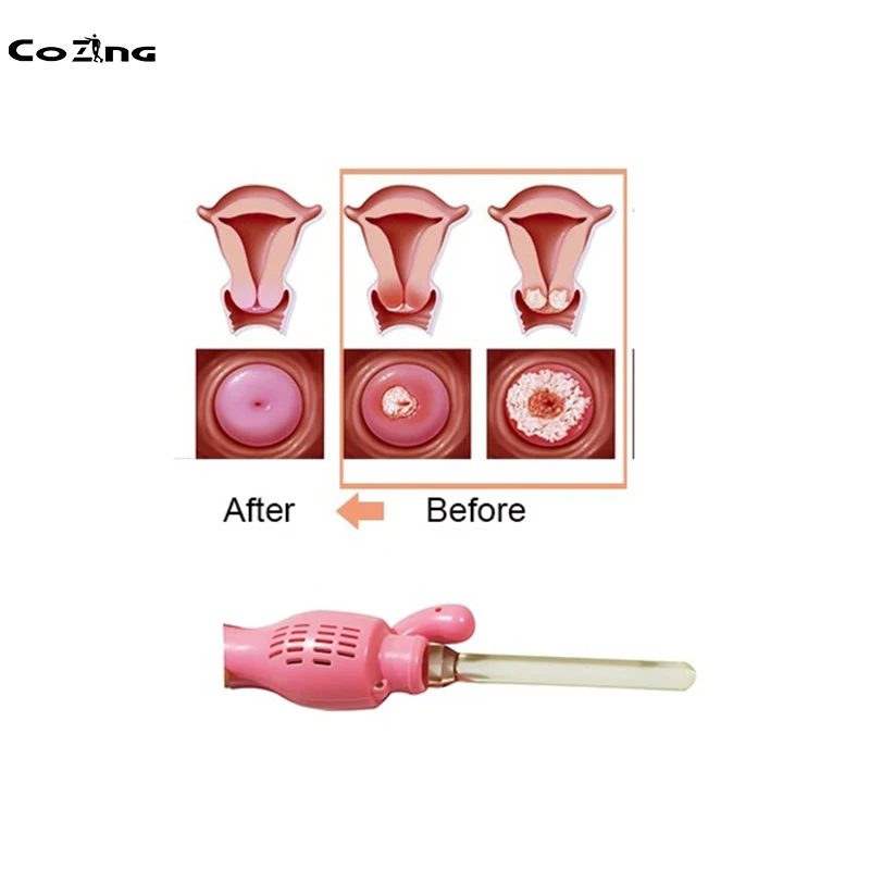 

Potable Women Massage Wand Red Light Therapy Device Healthcare Machine With Cold Red Light