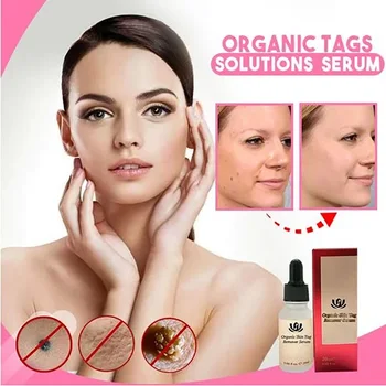 

Organic Skin Spot Purifying Serum ALL NATURAL TAGS FREE Mole & TAG REMOVAL New